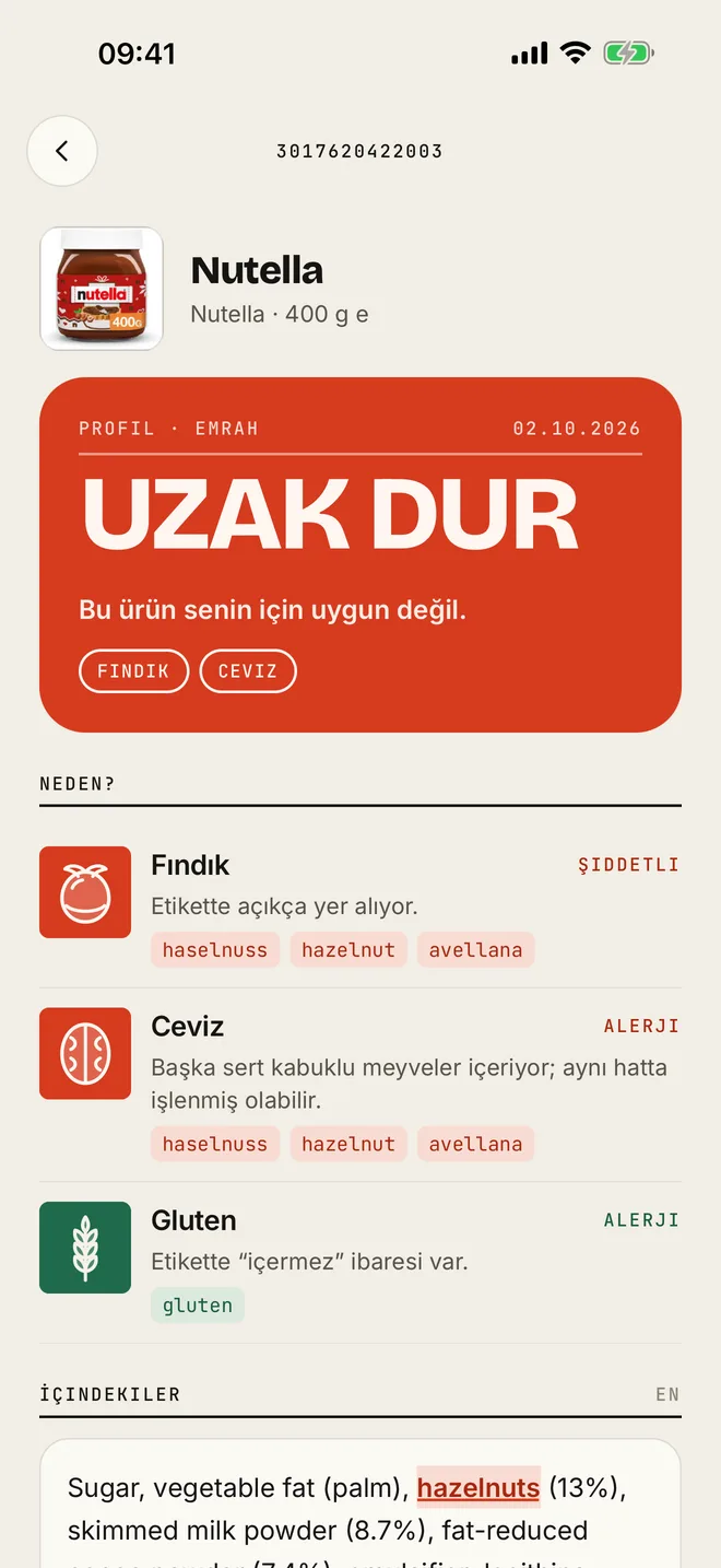 SafeFood — Kişisel Alerji Tarayıcı Mobil Uygulama